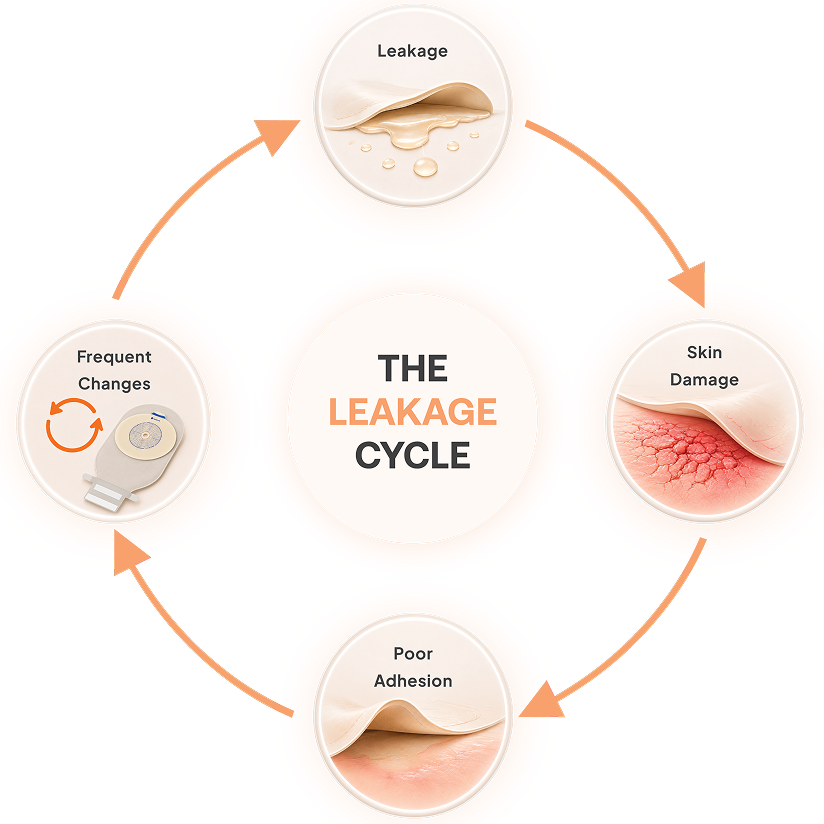 Breaking the Cycle of
Leakage & Skin Damage